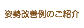 姿勢改善例のご紹介